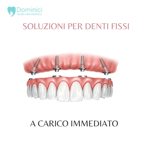 carico immediato
