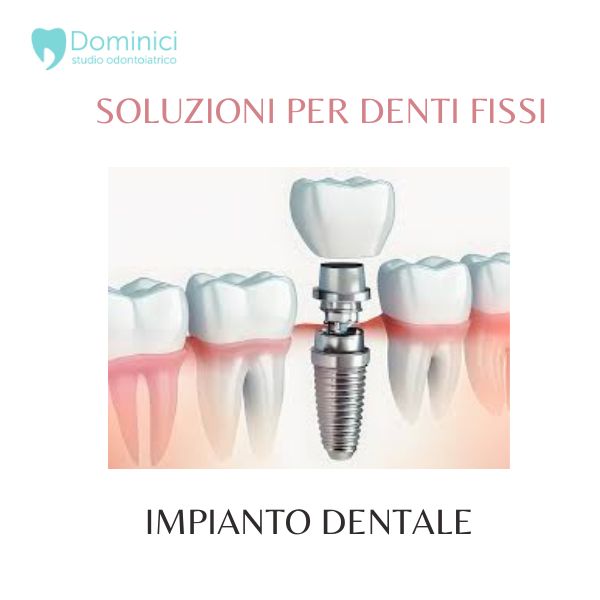 impianto dentale